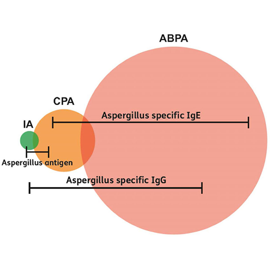 Aspergillus Antibodies Panel IgG IgM, Serum